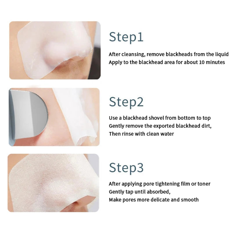 Nose Blackhead Whitehead Remover Scraper Deep Pore Cleaner Facial Skin Cleaning Tool Professional Face Care Beauty Device