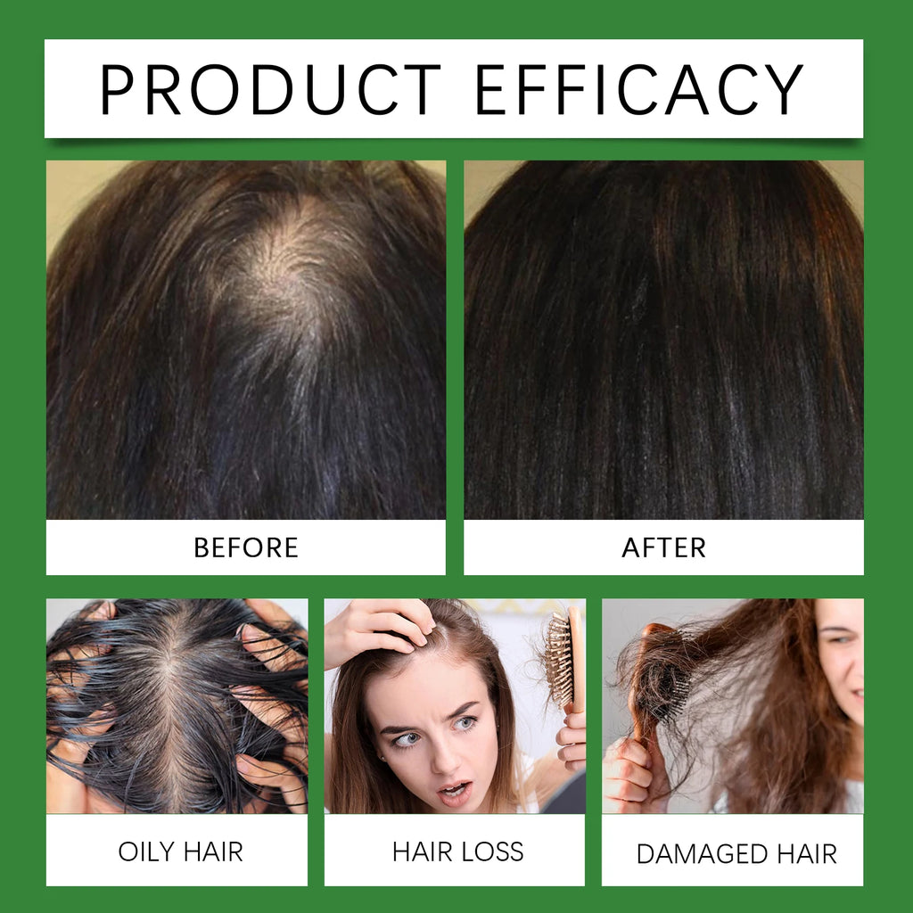 Rosemary Rice Water Hair Spray Nourishing Scalp Mist Strengthening Hair Roots Anti Hair Breakage Repair Dry Damaged Hair Leave-in Spray