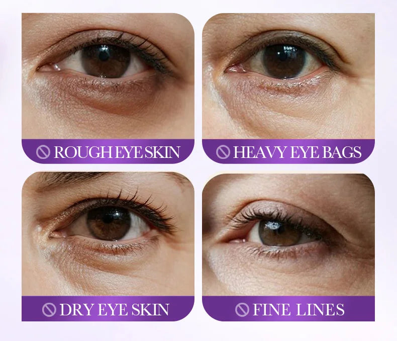 60pcs SADOER Probiotic Collagen Eye Mask Anti-aging Hydration Nourish Eye Skin Anti Dark Circles Smooth Fine Lines Eye Care