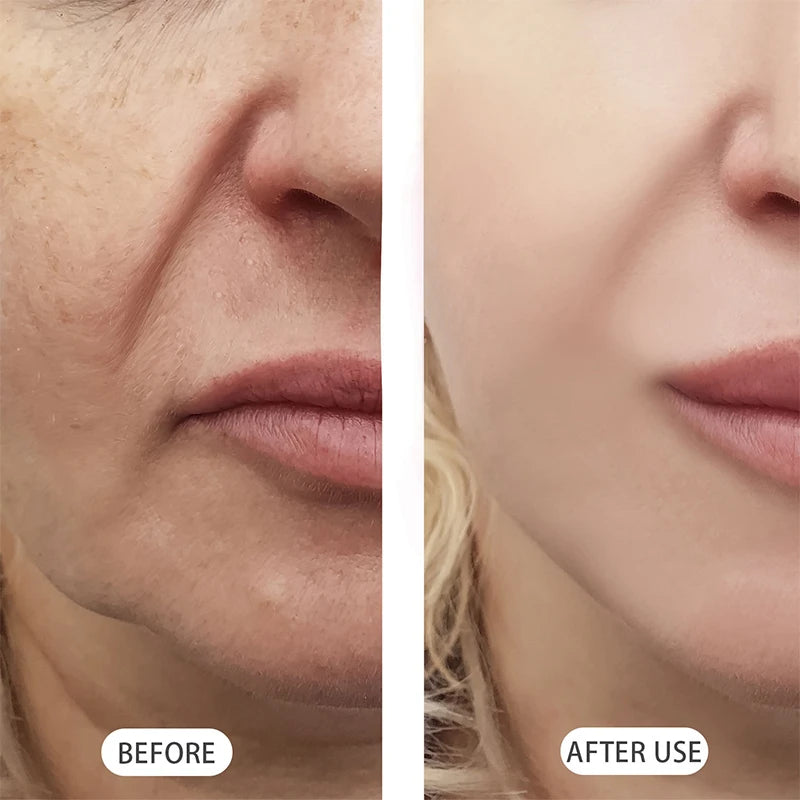 Nad Bio Wrinkle-reducing Facial Serum Set Enhance Elasticity Anti-aging Moisturizing Brighten Deep Skin Repair Skin Care Essence