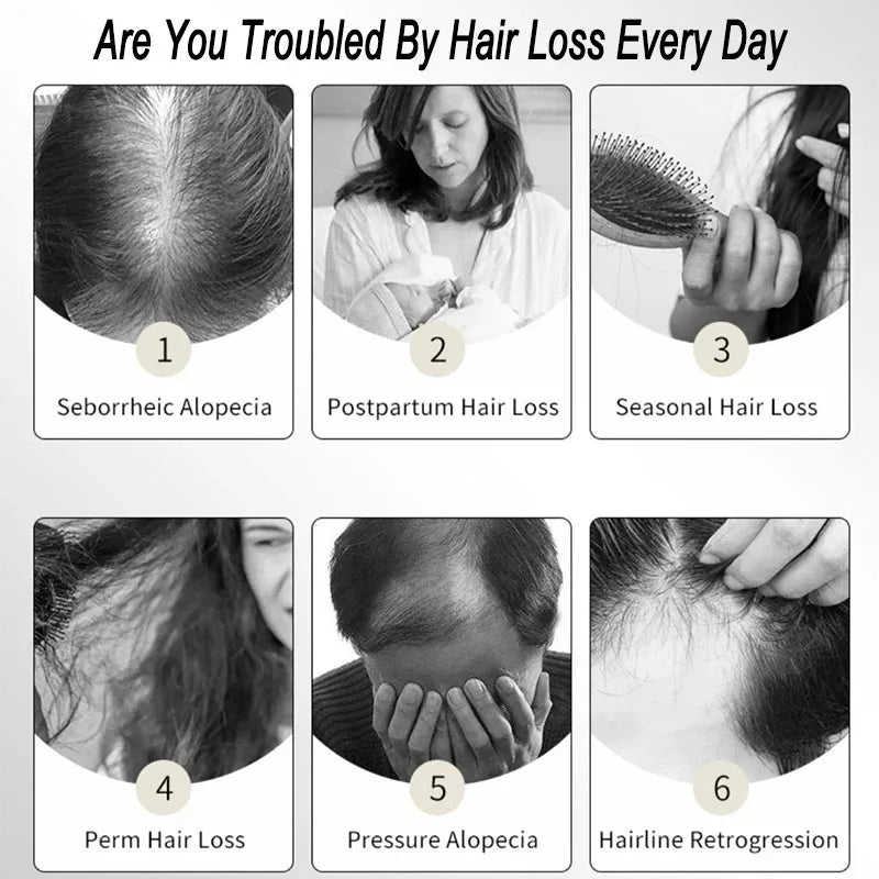 7 Biotin Hair Nourishing Essence Products Care Scalp Massage Anti Hair Loss Thicker Hair Serum Say Goodbye to Baldness