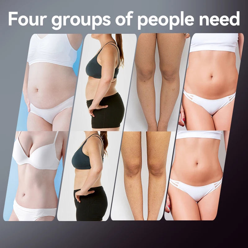 EMS & RF Body Slimming Device Cellulite Remover Pulse Fat Burner Body Shaping Lose Weight Machine for Belly Waist Arm Leg Butt