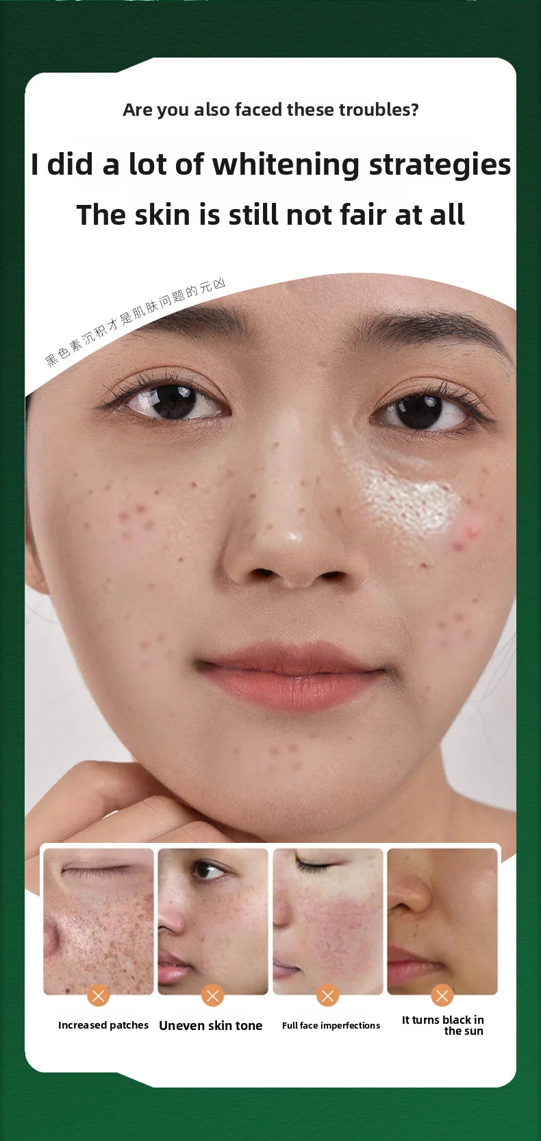 Whitening and freckle removal cream: moisturizing, brightening, rejuvenating, whitening, improving dull skin
