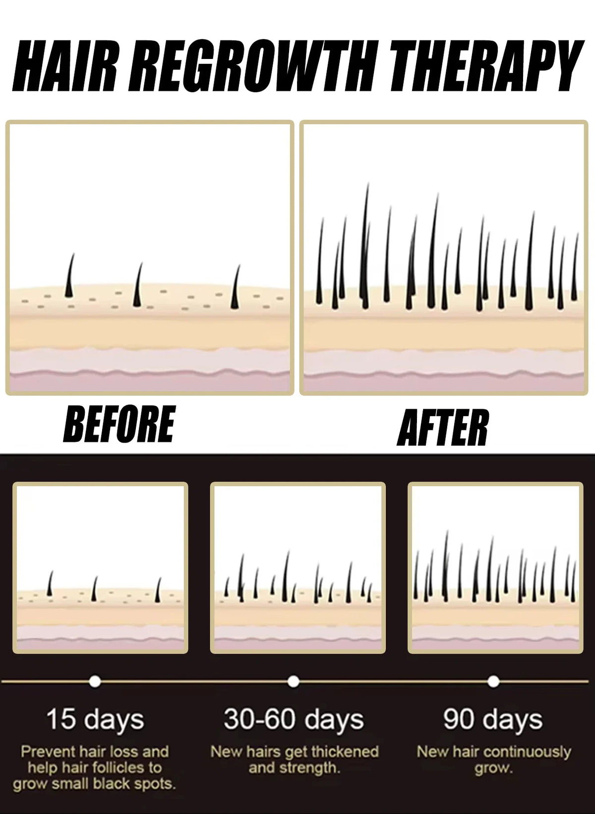 Anti-Hair Loss Essence Serum Promotes Hair Growth Improves Scalp Environment Hair Care