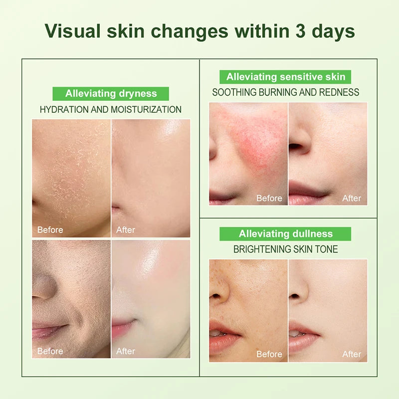 AUQUEST Niacinamide Face Cream Whitening  Moisturizing Hyaluronic Acid Smoothing Brightening Facial Cream Skin Care