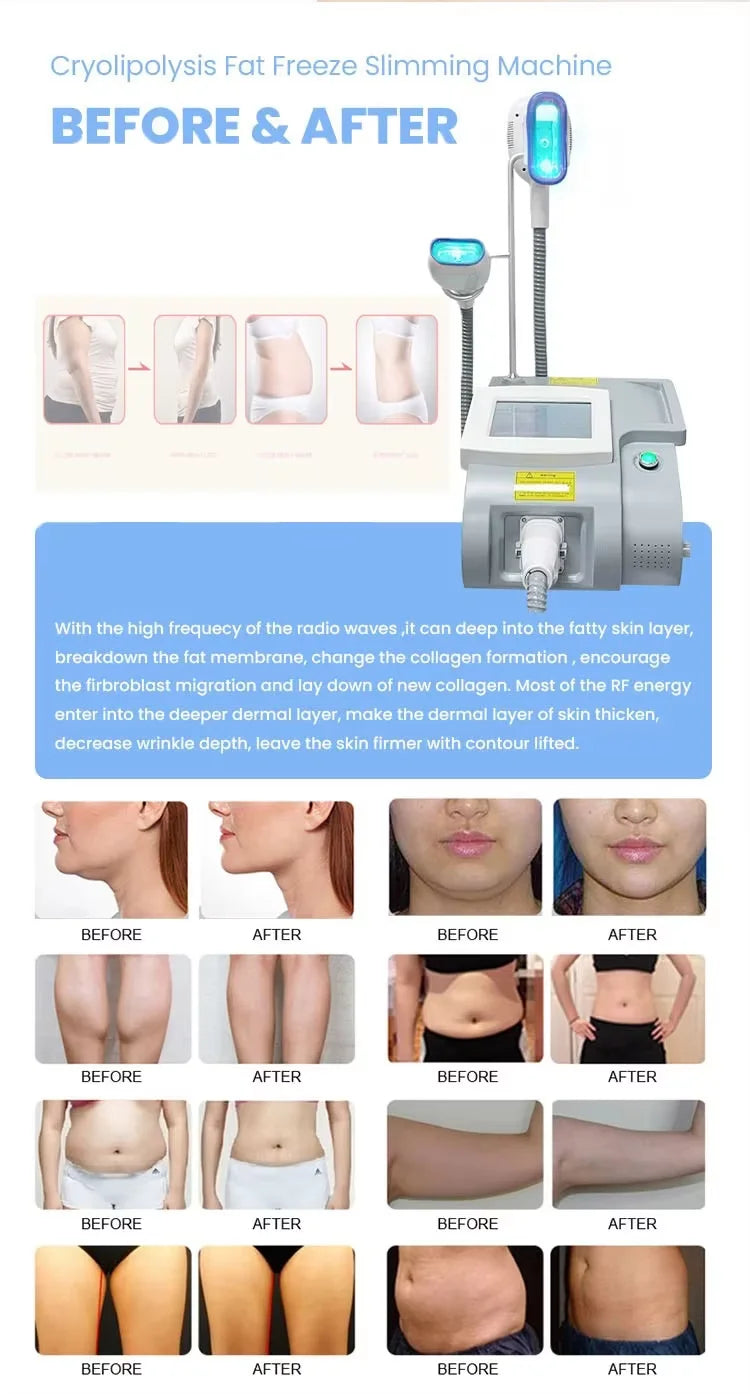 Portable 360 Cooling Sculpting Body Slimming Machine Loss Weight Fat Freezing 3 In 1 Cellulite Removal Vacuum Cavitation Machine