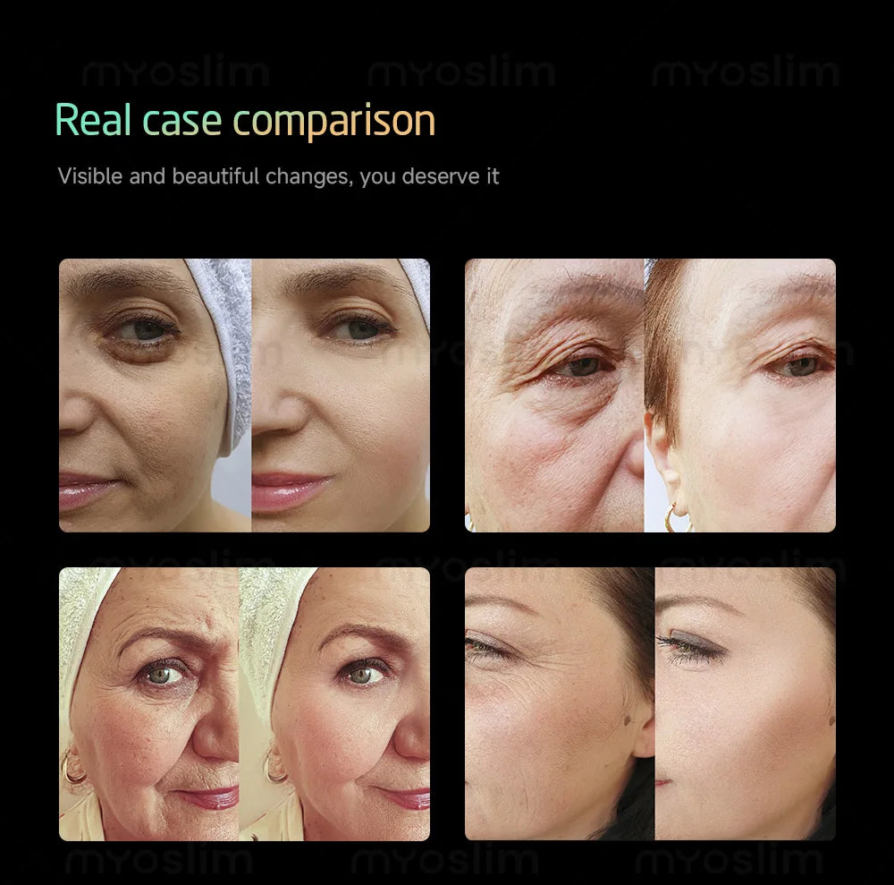 360MAX 25D HiFU Non Invasive 3 In 1 Machine Facial Slimming Anti Aging Body Firming Professional Beauty Treatment Device