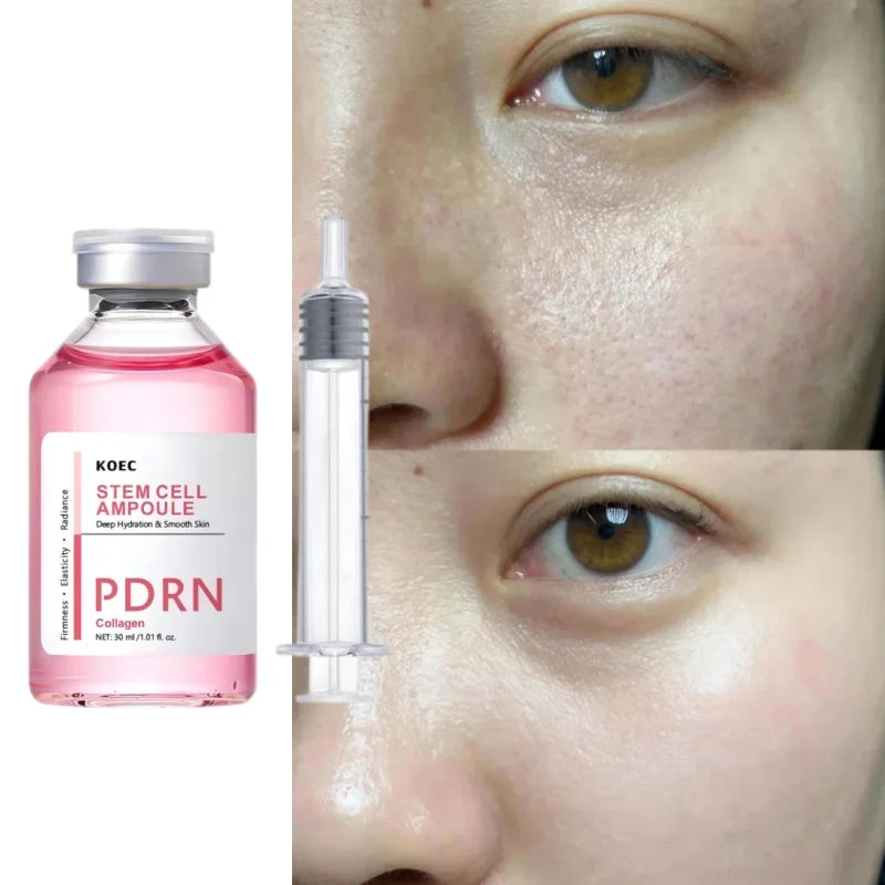 Pdrn Salmon Moisturizing Essence Collagen Blue Copper Peptide Deeply Moisturize Improve Dry Dull Firm Skin Korean Skincare New