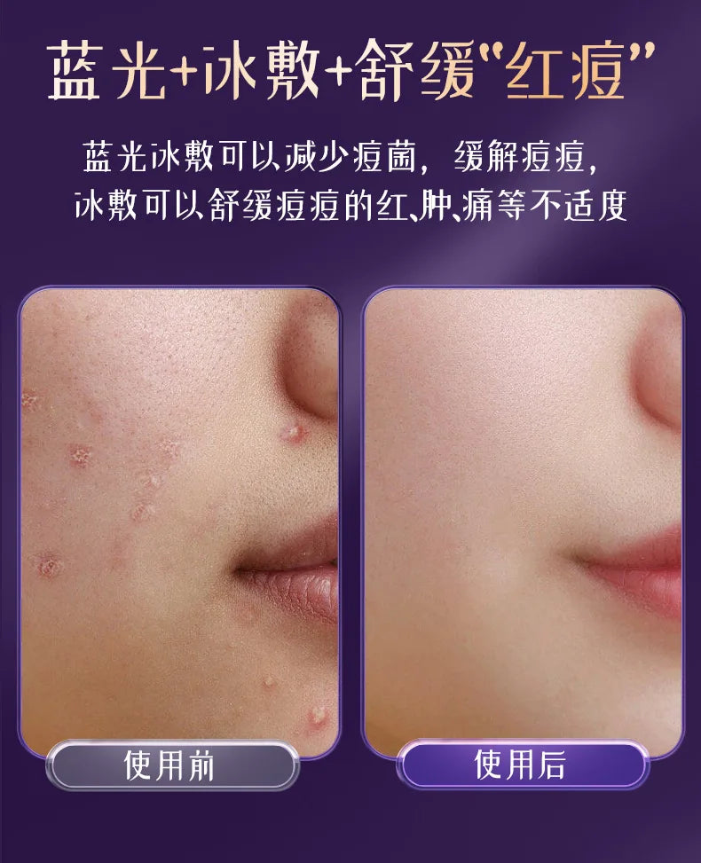 Beauty Device Facial Massage And Cleansing Devices Micro-Current Lifting Facial Massager