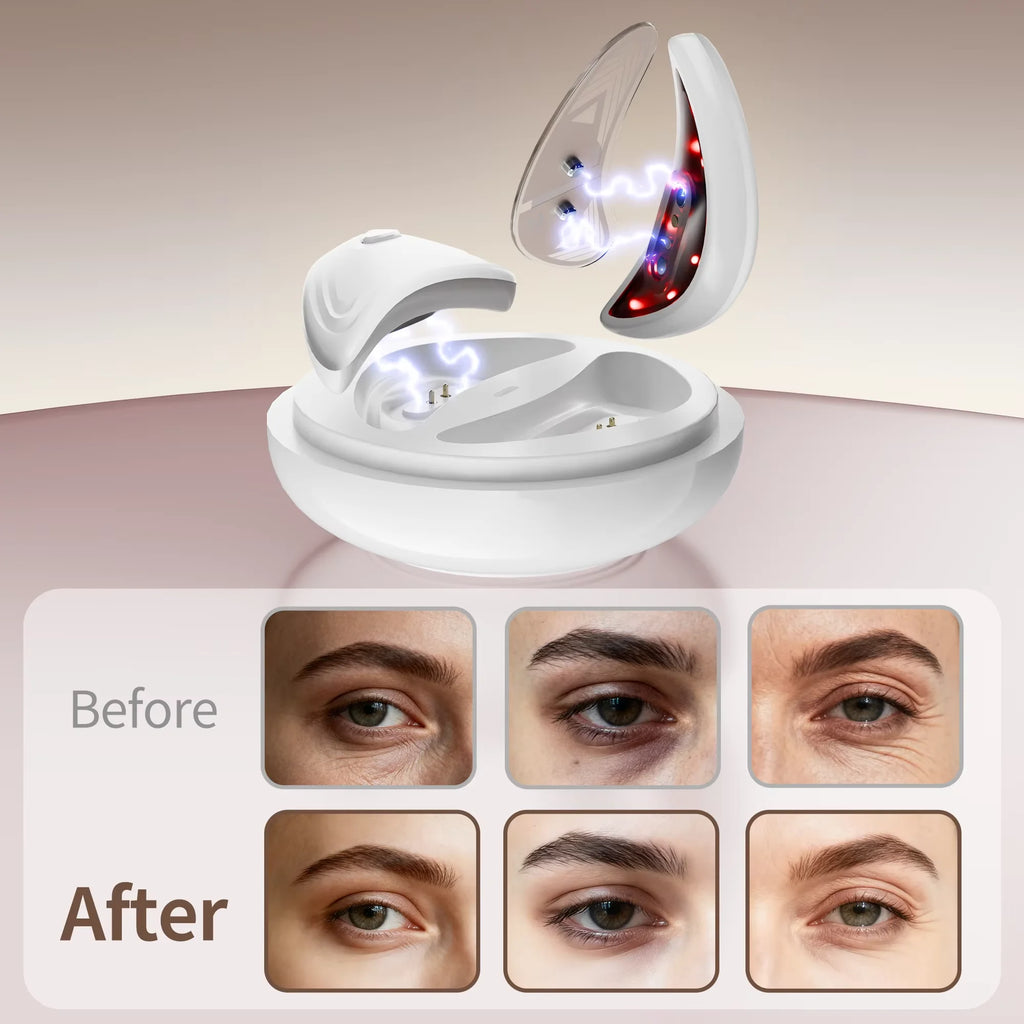 EMS Facial Eye Beauty Device With Gel Patches Red Light Eye Firming Massage For Eye Care Reducing Eye Bags Dark Circles