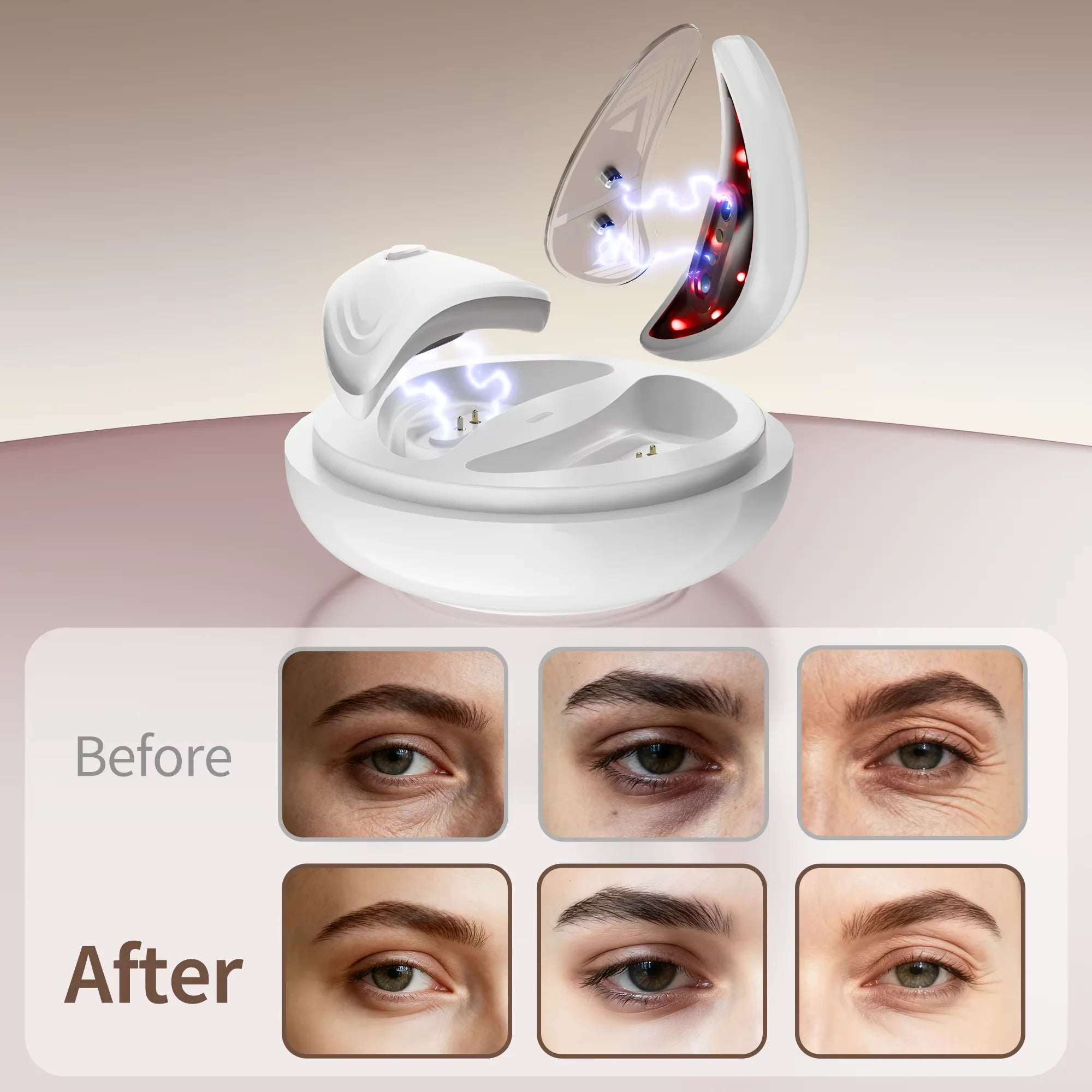 EMS Facial Eye Beauty Device With Gel Patches Red Light Eye Firming Massage For Eye Care Reducing Eye Bags Dark Circles