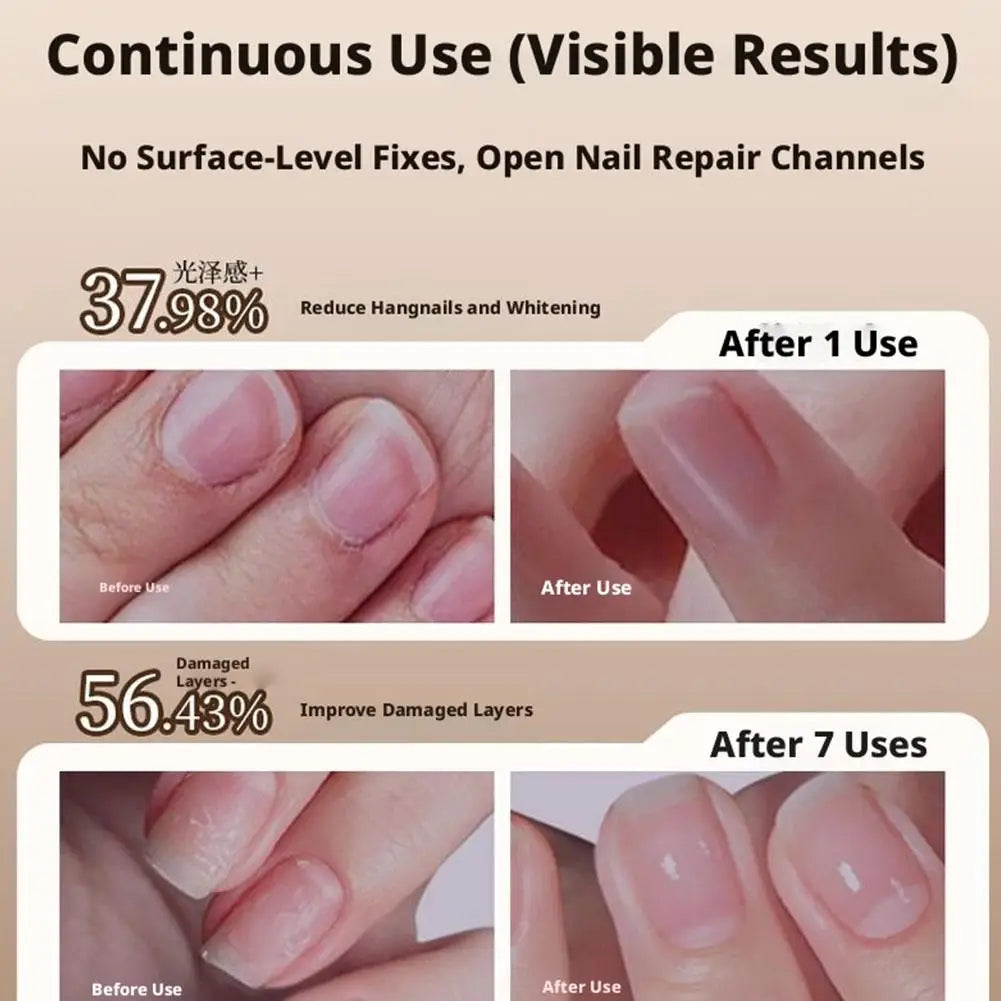Nails 3-in-1 Cuticle Oil Pen with Ceramic Nail Pusher for Hangnails Dry & Damaged Nails -Nail Care Pen for Repair & Nourishment