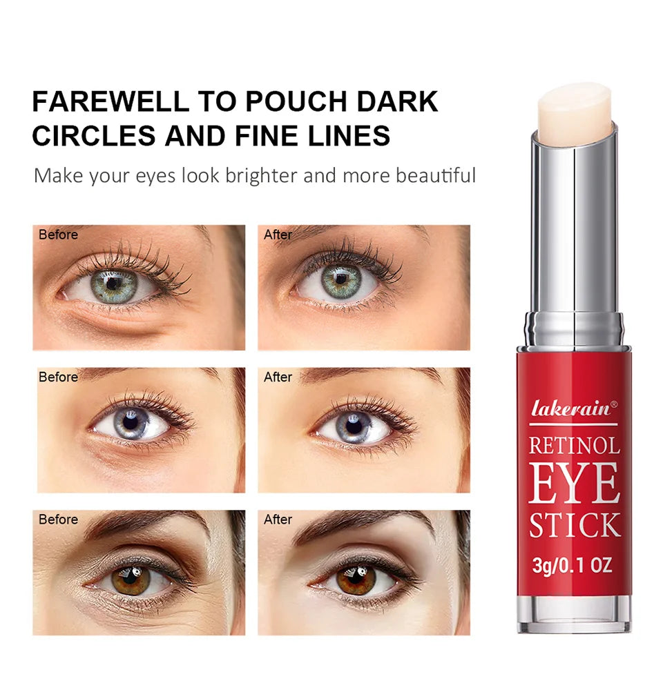 Anti-Wrinkle Eye Cream Retinol Remove Eye Bags Dark Circles Anti Aging Lifting Whitening Moisturizing Brighten Eye Primer