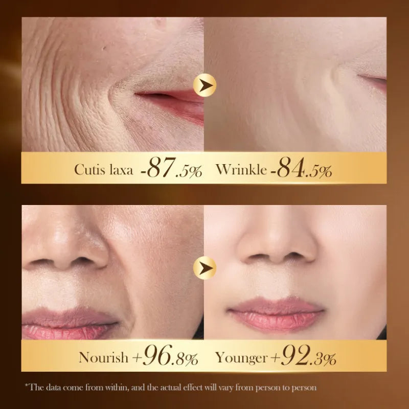 SADOER Caviar DNA Sodium Collagen Frming Cream for Moisturizing Nourish Anti-age Skin Care 30g