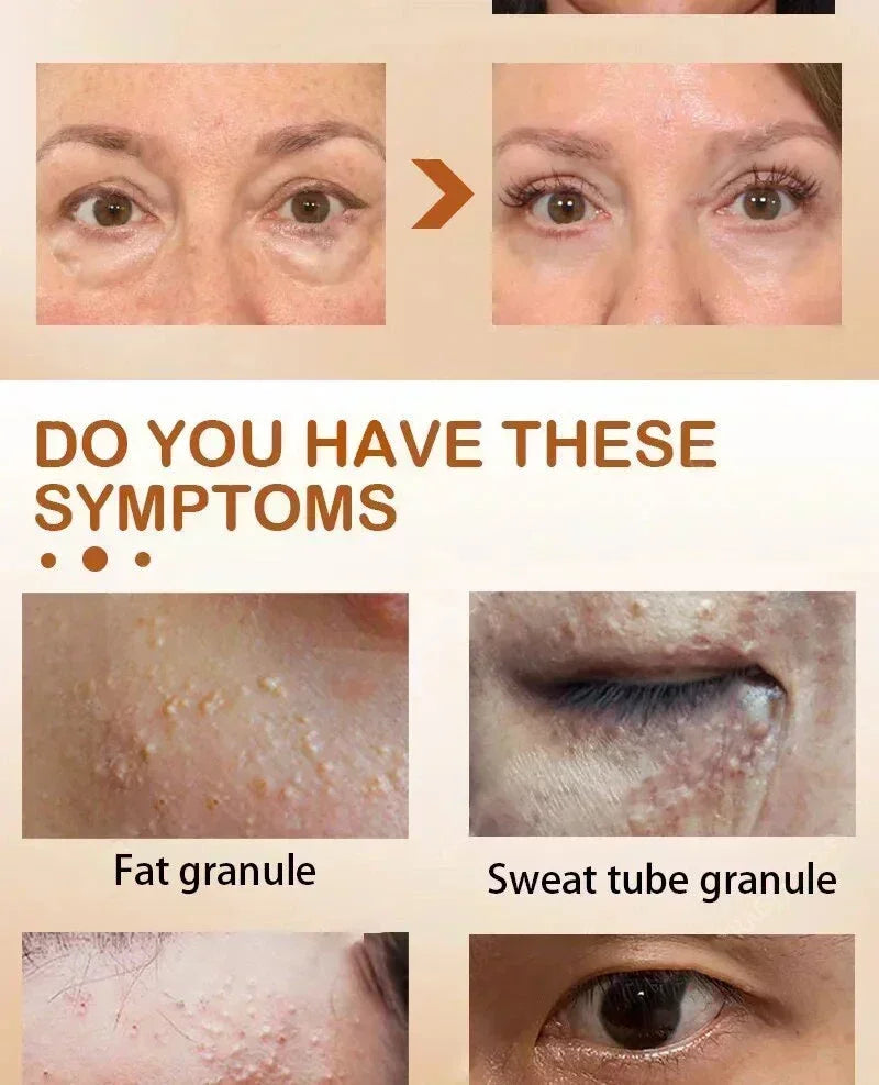 Anti-Wrinkle Remove bags Puffiness Dark Circles under eyes Lightening Fine Lines Moisturizing Whitening Skin Care