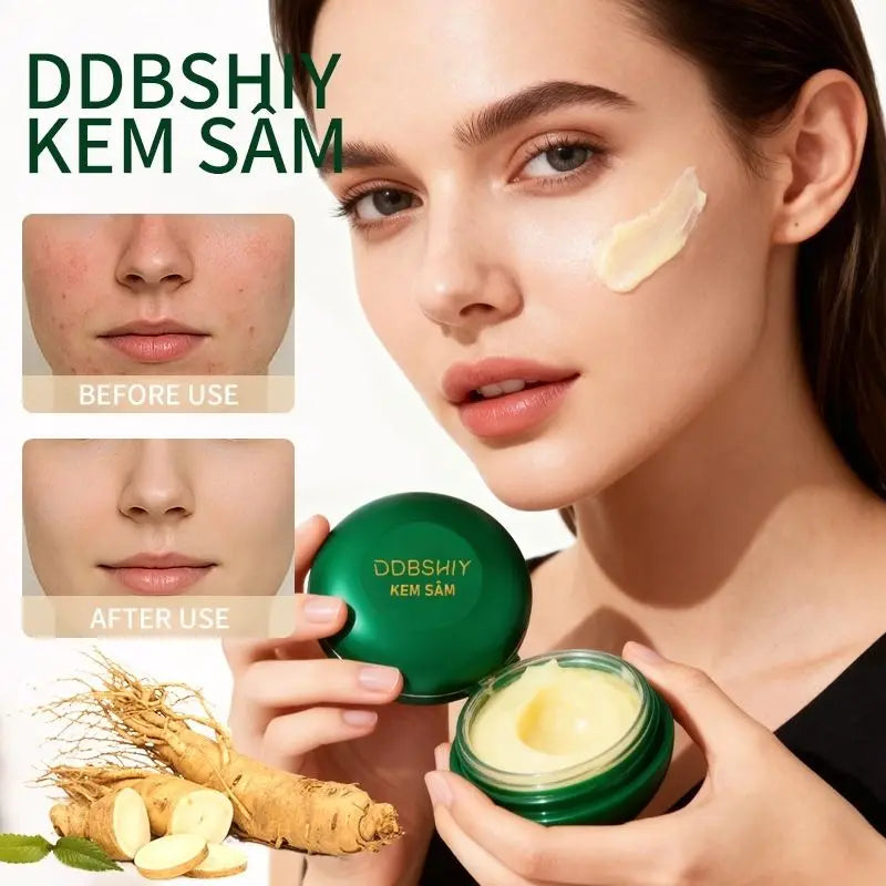 Anti-Acne Whitening Face Cream – Ginseng Moisturizer for Dark Spots & Dull Skin – Nourishing 7g Vietnamese Cream