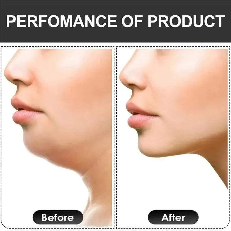 New Facial Mouth Jawline Face Fitness Muscle Chew Ball Bite Breaker Training Equipment U Shape Jaw Exerciser
