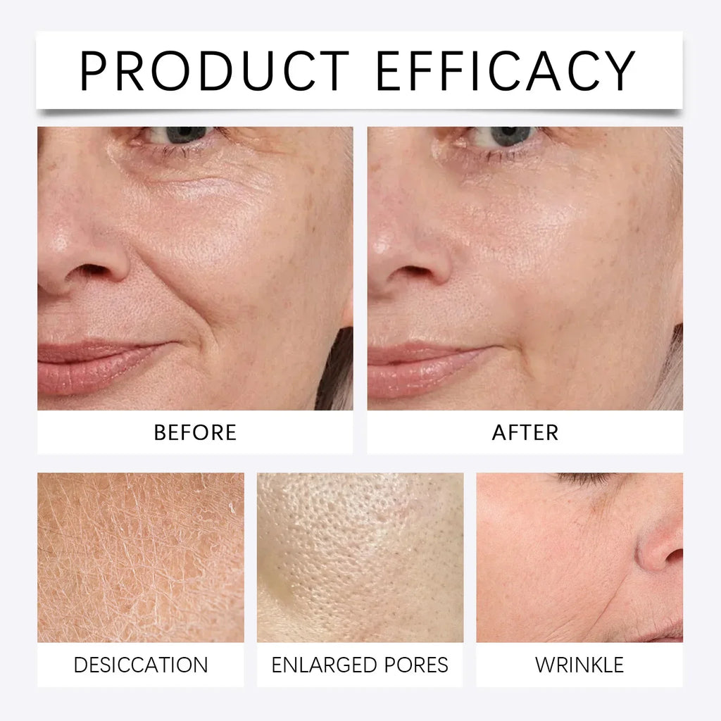 NEW  2 Tools + 6 Bottles Korean Moisturizing Renewal Set, Smooth Skin Feeling Lines Daily Skin Care Essence 0.3mm Microneedle