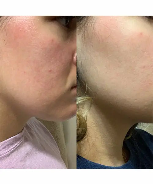 Beauty Edit - Multi Use Treatment Oil - Beauty